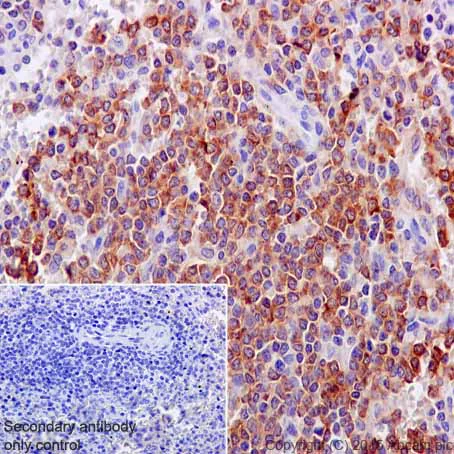 Immunohistochemistry (Formalin/PFA-fixed paraffin-embedded sections) - Anti-BTF3 antibody [EPR16495] (AB203517)