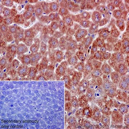 Immunohistochemistry (Formalin/PFA-fixed paraffin-embedded sections) - Anti-BTF3 antibody [EPR16495] (AB203517)