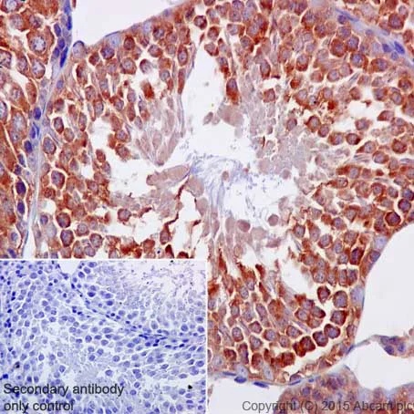 Immunohistochemistry (Formalin/PFA-fixed paraffin-embedded sections) - Anti-BTF3 antibody [EPR16495] (AB203517)