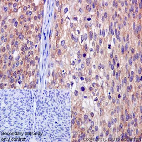 Immunohistochemistry (Formalin/PFA-fixed paraffin-embedded sections) - Anti-BTF3 antibody [EPR16495] (AB203517)