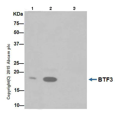 Immunoprecipitation - Anti-BTF3 antibody [EPR16495] (AB203517)