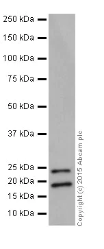 Western blot - Anti-BTF3 antibody [EPR16495] (AB203517)