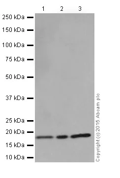 Western blot - Anti-BTF3 antibody [EPR16495] (AB203517)