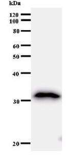 Western blot - Anti-BTG1 antibody [2095C1a] (AB50991)