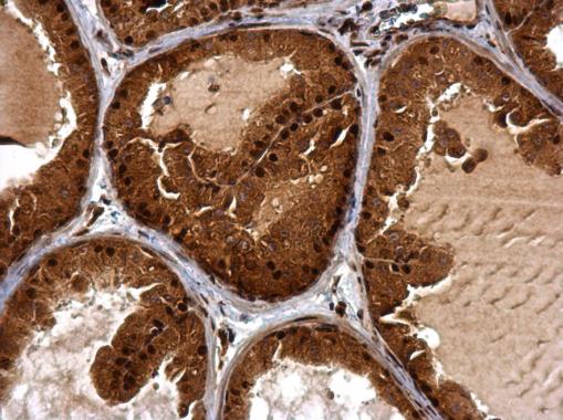 Immunohistochemistry (Formalin/PFA-fixed paraffin-embedded sections) - Anti-BTG1 antibody (AB227162)