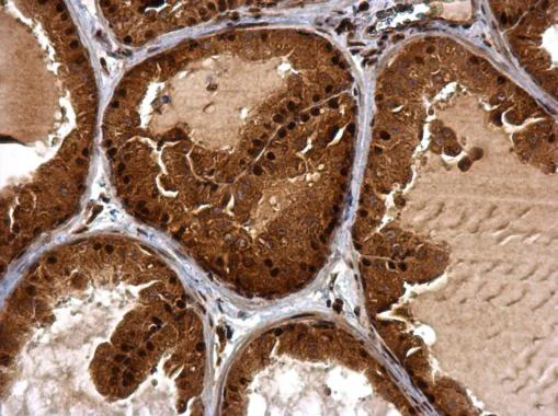 Immunohistochemistry (Formalin/PFA-fixed paraffin-embedded sections) - Anti-BTG1 antibody (AB227162)