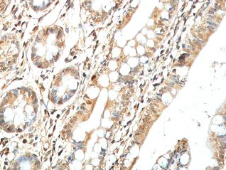 Immunohistochemistry (Formalin/PFA-fixed paraffin-embedded sections) - Anti-BTG2/PC3 antibody (AB85051)