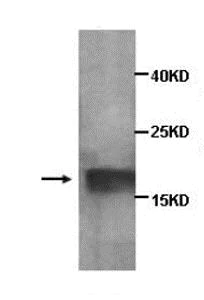 Western blot - Anti-BTG2/PC3 antibody (AB85051)