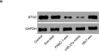 Western blot - Anti-BTG2/PC3 antibody (AB85051)