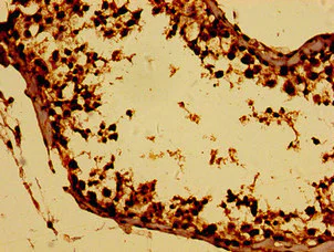 Immunohistochemistry (Formalin/PFA-fixed paraffin-embedded sections) - Anti-BTG4 antibody (AB235085)
