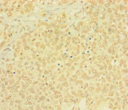 Immunohistochemistry (Formalin/PFA-fixed paraffin-embedded sections) - Anti-BTG4 antibody (AB235085)