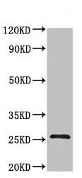 Western blot - Anti-BTG4 antibody (AB235085)