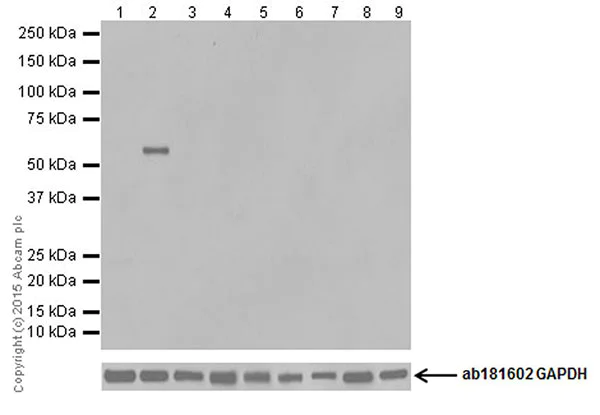 Western blot - Anti-BTG4 antibody [EPRZJU-21] - BSA and Azide free (AB251461)