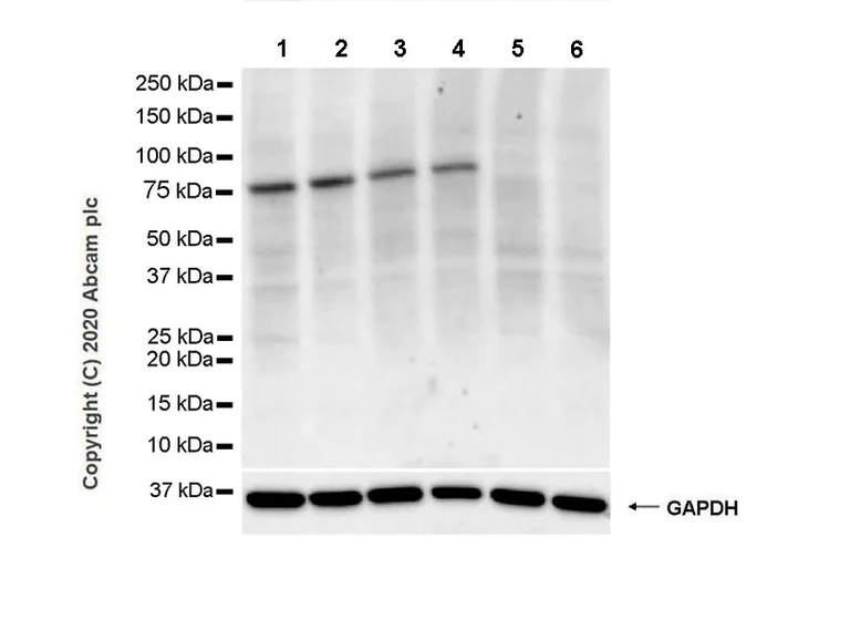 Western blot - Anti-BTK antibody [10D11] - BSA and Azide free (AB255892)