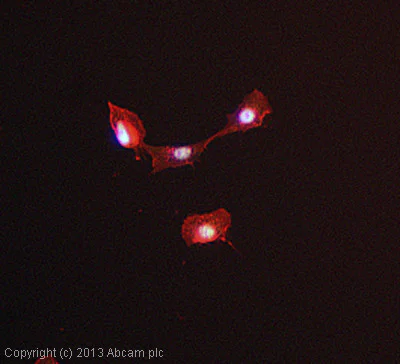 Immunocytochemistry/ Immunofluorescence - Anti-BTK antibody (AB137503)