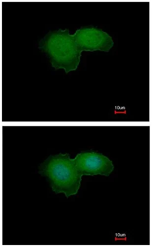 Immunocytochemistry/ Immunofluorescence - Anti-BTK antibody (AB137503)