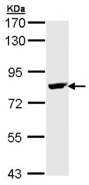 Western blot - Anti-BTK antibody (AB137503), expandable thumbnail