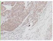 Immunohistochemistry (Formalin/PFA-fixed paraffin-embedded sections) - Anti-BTK antibody (AB137504)
