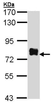 Western blot - Anti-BTK antibody (AB137504)