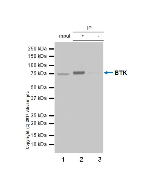 Immunoprecipitation - Anti-BTK antibody [EPR20445] (AB208937)