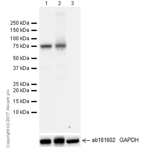 Western blot - Anti-BTK antibody [EPR20445] (AB208937)