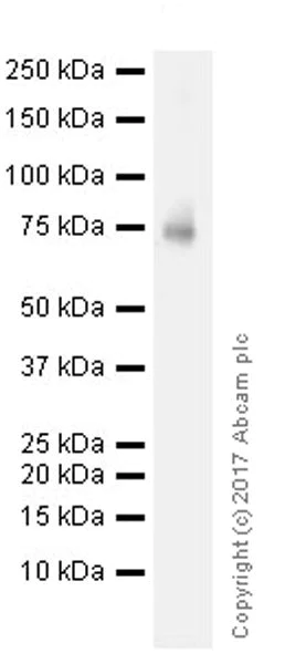 Western blot - Anti-BTK antibody [EPR20445] (AB208937)