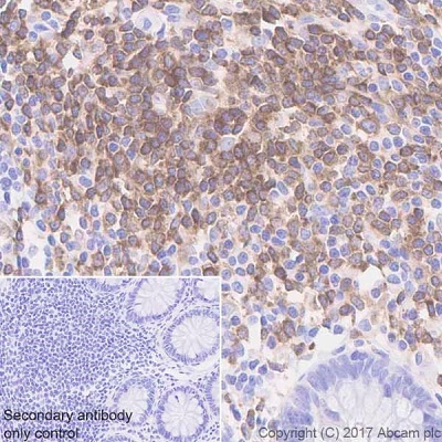 Immunohistochemistry (Formalin/PFA-fixed paraffin-embedded sections) - Anti-BTK antibody [EPR20445] - BSA and Azide free (AB227812)