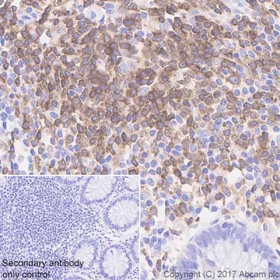 Immunohistochemistry (Formalin/PFA-fixed paraffin-embedded sections) - Anti-BTK antibody [EPR20445] - BSA and Azide free (AB227812)