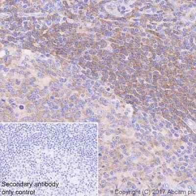Immunohistochemistry (Formalin/PFA-fixed paraffin-embedded sections) - Anti-BTK antibody [EPR20445] - BSA and Azide free (AB227812)