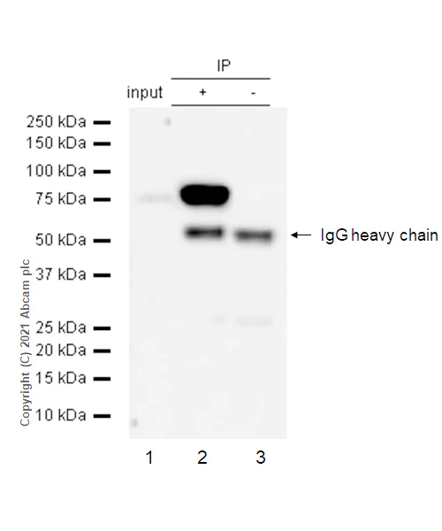 Immunoprecipitation - Anti-BTK antibody [Y440] (AB32555)