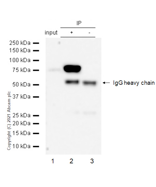 Immunoprecipitation - Anti-BTK antibody [Y440] - BSA and Azide free (AB247268), expandable thumbnail
