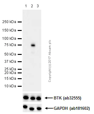 Western blot - Anti-BTK (phospho Y223) antibody [EP420Y] (AB68217)