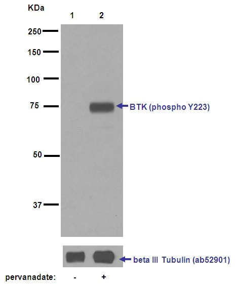 Western blot - Anti-BTK (phospho Y223) antibody [EP420Y] (AB68217)
