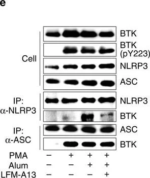 Western blot - Anti-BTK (phospho Y223) antibody [EP420Y] (AB68217)