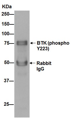 Immunoprecipitation - Anti-BTK (phospho Y223) antibody [EP420Y] - BSA and Azide free (AB190919)