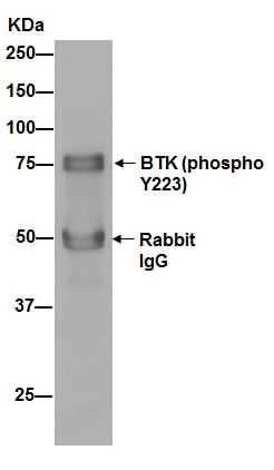 Immunoprecipitation - Anti-BTK (phospho Y223) antibody [EP420Y] - BSA and Azide free (AB190919)