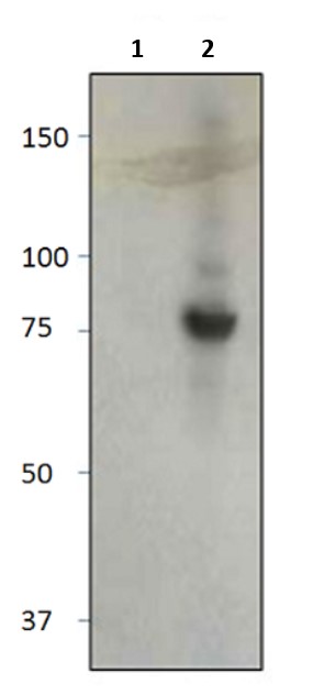 Western blot - Anti-BTK (phospho Y551) antibody (AB180549)