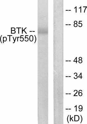 Western blot - Anti-BTK (phospho Y551) antibody (AB52192)