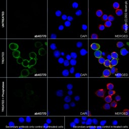 Immunocytochemistry/ Immunofluorescence - Anti-BTK (phospho Y551) antibody [EP267Y] - BSA and Azide free (AB247285), expandable thumbnail
