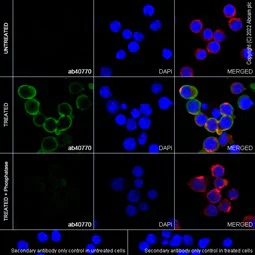 Immunocytochemistry/ Immunofluorescence - Anti-BTK (phospho Y551) antibody [EP267Y] - BSA and Azide free (AB247285)
