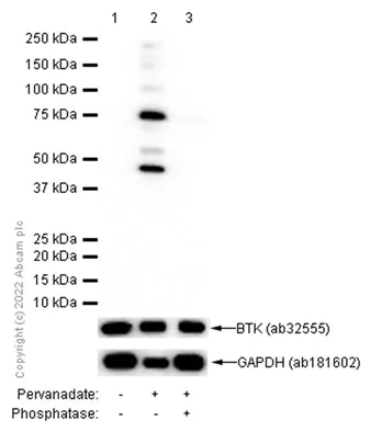 Western blot - Anti-BTK (phospho Y551) antibody [EP267Y] - BSA and Azide free (AB247285)