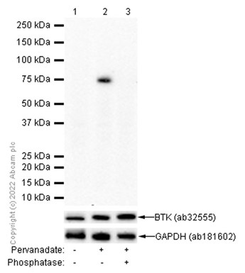 Western blot - Anti-BTK (phospho Y551) antibody [EP267Y] - BSA and Azide free (ab247285), expandable thumbnail