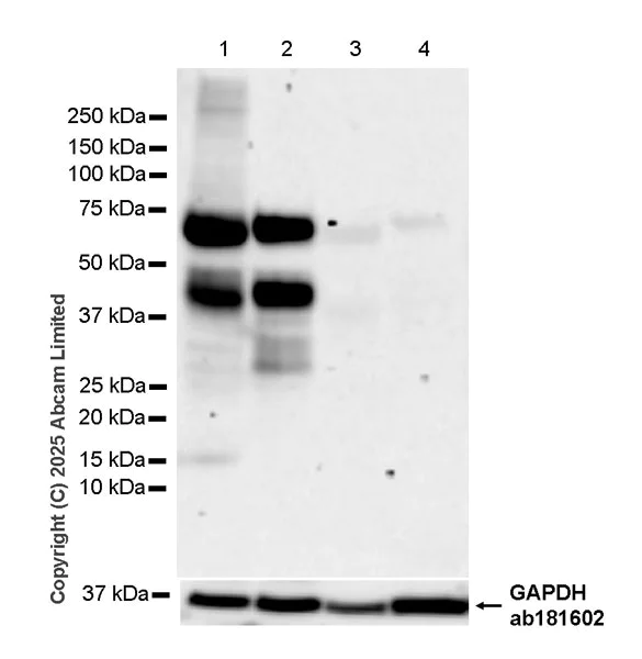 Western blot - Anti-BTLN9 antibody [EPR30751-624] (AB325500)