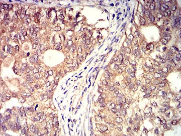 Immunohistochemistry (Formalin/PFA-fixed paraffin-embedded sections) - Anti-BTN2A2/BTF2 antibody [6C7D2] (AB233763)