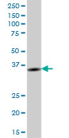 Western blot - Anti-BTN3A2 antibody (AB68546)