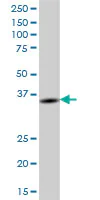 Western blot - Anti-BTN3A2 antibody (AB68546)
