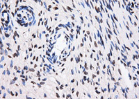 Immunohistochemistry (Formalin/PFA-fixed paraffin-embedded sections) - Anti-BTN3A2 antibody [OTI1A6] (ab118051), expandable thumbnail