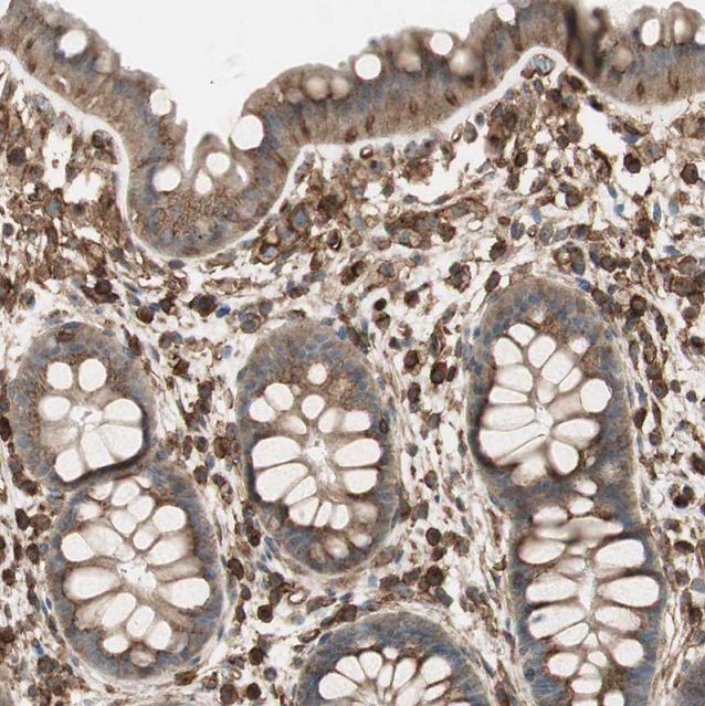 Immunohistochemistry (Formalin/PFA-fixed paraffin-embedded sections) - Anti-BTN3A3 antibody (AB251692)