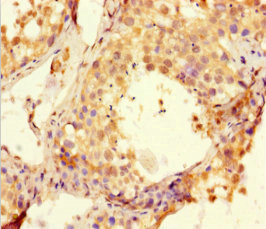 Immunohistochemistry (Formalin/PFA-fixed paraffin-embedded sections) - Anti-BTNL2 antibody (AB223053), expandable thumbnail