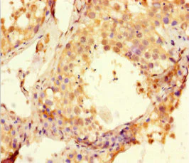 Immunohistochemistry (Formalin/PFA-fixed paraffin-embedded sections) - Anti-BTNL2 antibody (AB223053)
